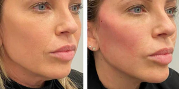 Transformação - Cláudia M.