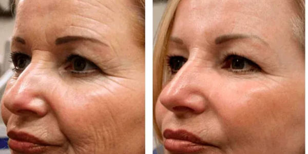 Transformação - Márcia T.