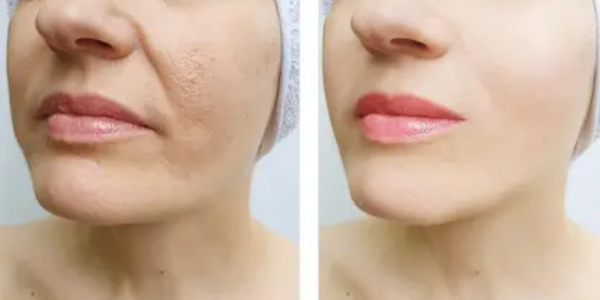 Transformação - Fernanda L.