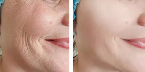 Transformação - Berenice A.